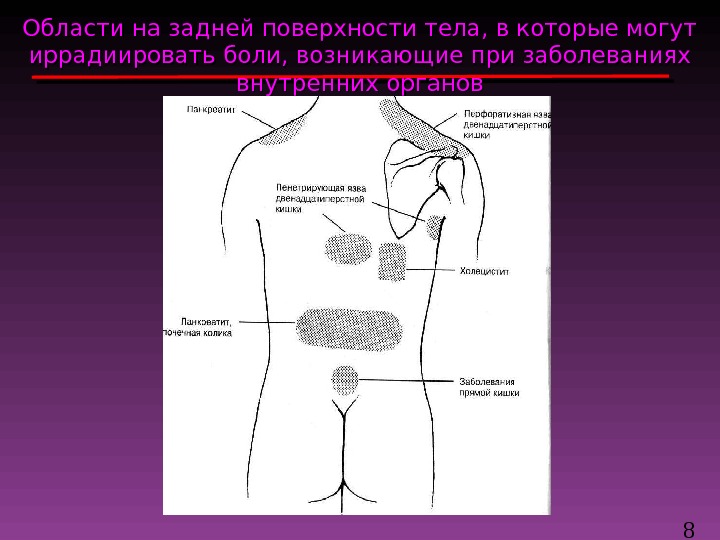 Постхолецистэктомический синдром презентация