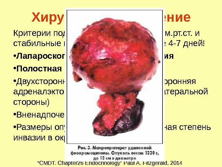 Феохромоцитома презентация қазақша