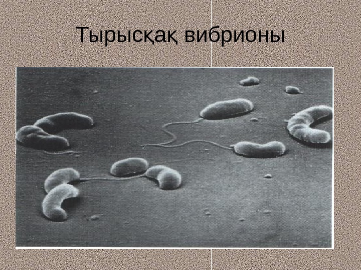 Трутовик окаймленный холерный вибрион. Вибрионы. Вибрионы бактерии. Как выглядят бактерии вибрионы. Холерный вибрион.
