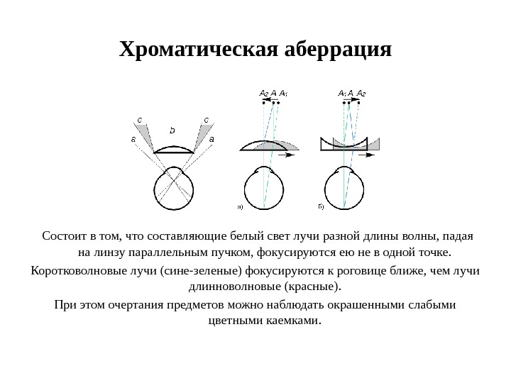 Хроматическая аберрация. Аберрации глаза физиология. Сферическая аберрация глаза. Сферическая аберрация глаза физиология. Хроматическая аберрация глаза.