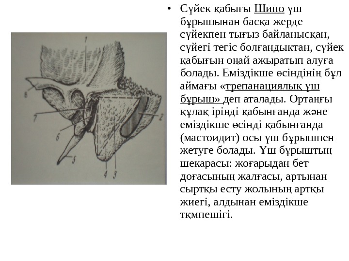 Трепанация треугольника шипо. Шипо треугольник анатомия. Сосцевидный отросток шипо. Треугольник шипо топографическая анатомия схема. Треугольник шипо границы.