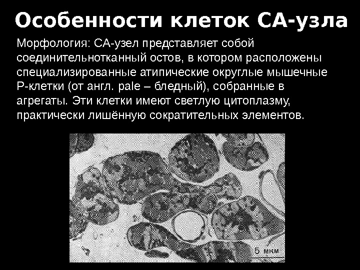 Узелки клеток. Узел клетки. Р-клетки в синоатриальном узле. Соединительнотканный остов. Клеточный узел 3.4.