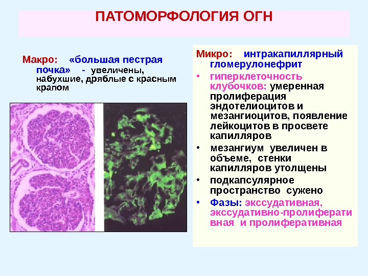 Тубулопатии у детей презентация