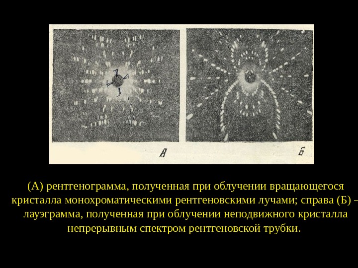 Обычное изображение получаемое при помощи рентгеновских лучей