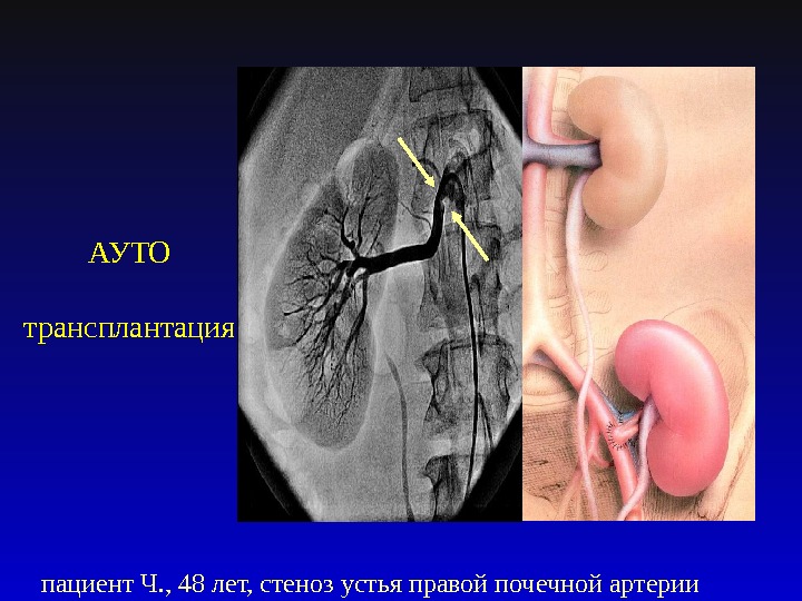 Клеточная трансплантология презентация