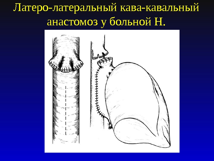 Клеточная трансплантология презентация