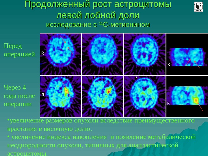 Позитронно эмиссионная томография презентация