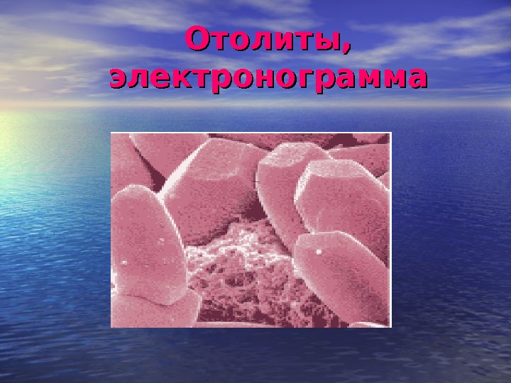 схема строения отолитового аппарата. отолитовый аппарат строение. отолиты. отолитовый аппарат строение схема. вестибулярный аппарат отолитовый аппарат.