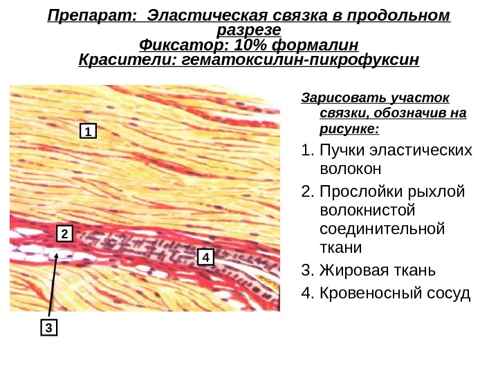 Плотная оформленная ткань сухожилия. Эластическая соединительная ткань гистология. Эластическая связка препарат гистология. Эластическая соединительная ткань выйная связка. Эластическая связка быка препарат гистология.