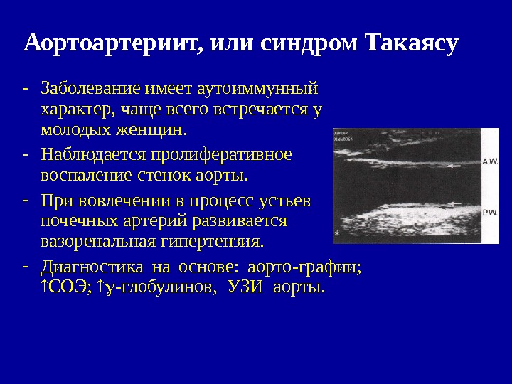 Синдромы узи. Артериит болезнь Такаясу. Неспецифический аортоартериит аорта. Патогенез аортоартериита Такаясу. Синдром Такаясу симптомы.