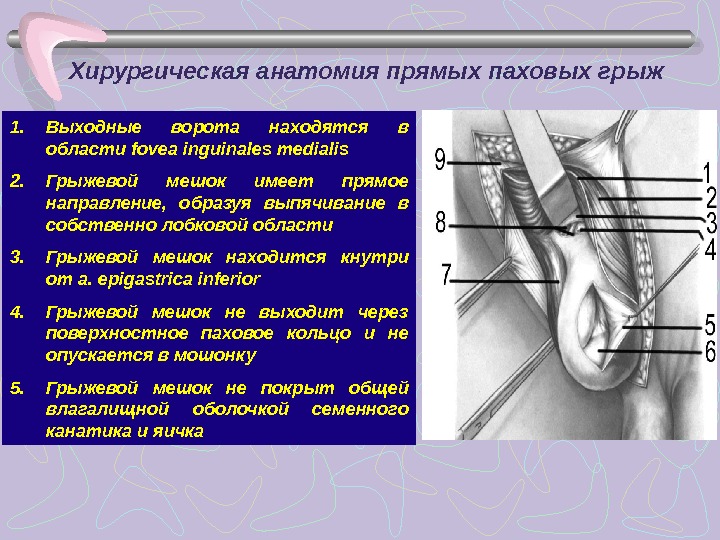 Паховая грыжа у мужчин где находится картинка причины симптомы и причины