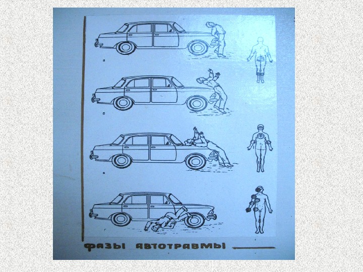 Автодорожная травма презентация