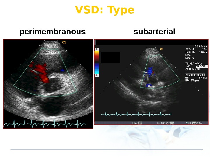 Открыт vsd