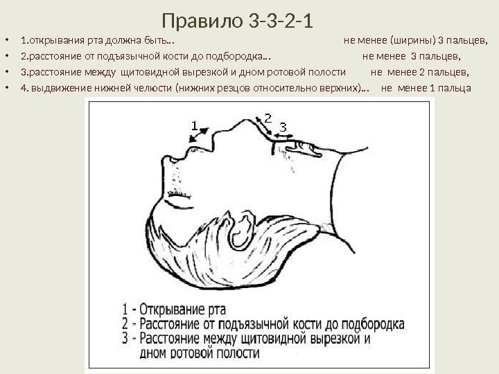 Всеобъемлющий изъять подъязычный призвание. Степень открывания р а.