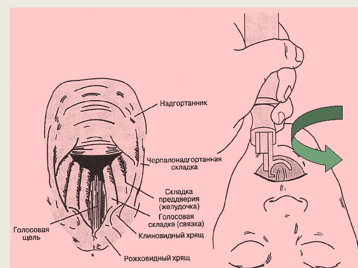 Надгортанник это. Черпалонадгортанная складка. Черпалонадглртанная складка. Черпалонадгортанная складка гортани. Черпало надгордвнная акладка.