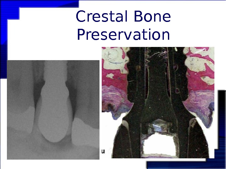 A Paradigm Shift in Prosthetic Dentistry Learning