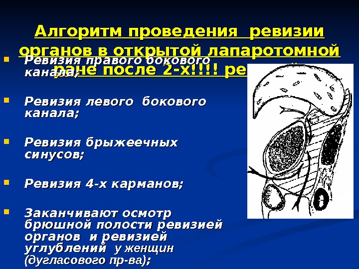 Ревизия брюшной полости это. Ревизия органов брюшной полости. Осмотр брюшной полости. Ревизия органов брюшной полости фото. Методика ревизии органов брюшной полости.