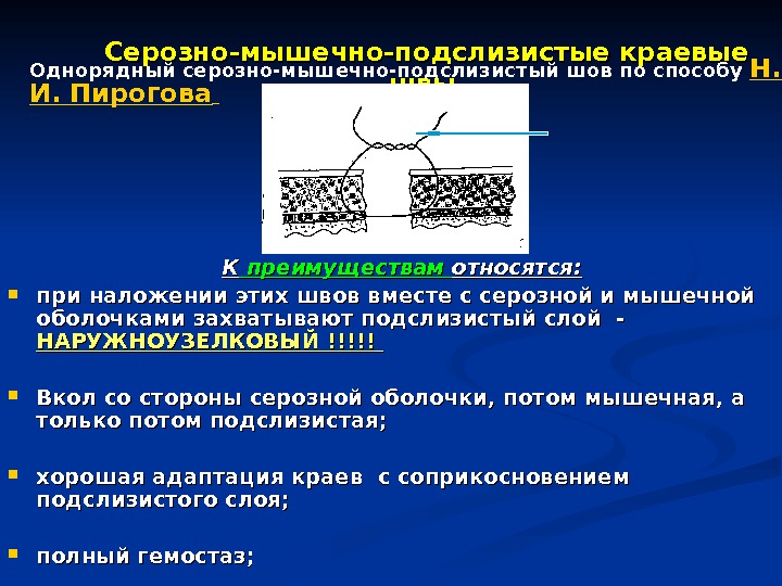 Трещины заднего прохода это дефект слоев а всей стенки б мышечного в подслизистого г слизистого