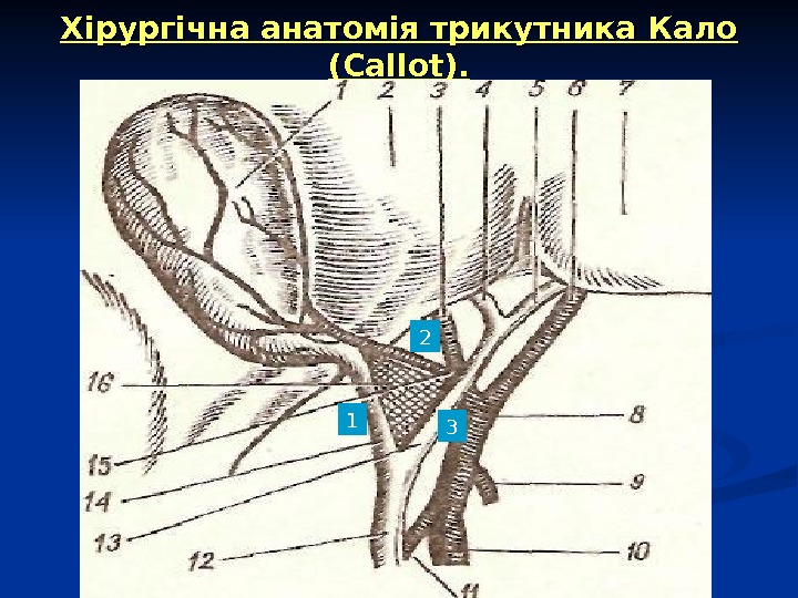 Треугольник кало схема