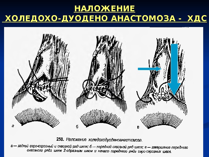 Абдоминальная пункция презентация