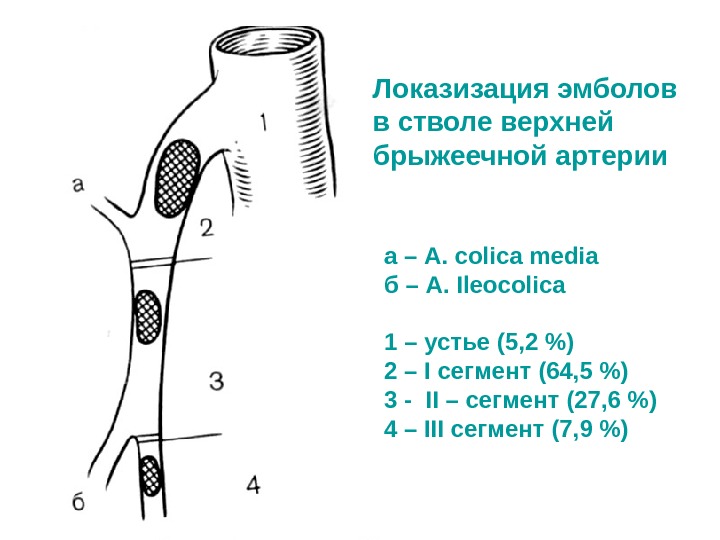 Верхняя брыжеечная артерия схема