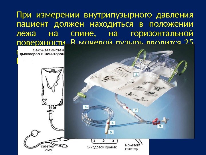 Внутрипузырная химиотерапия