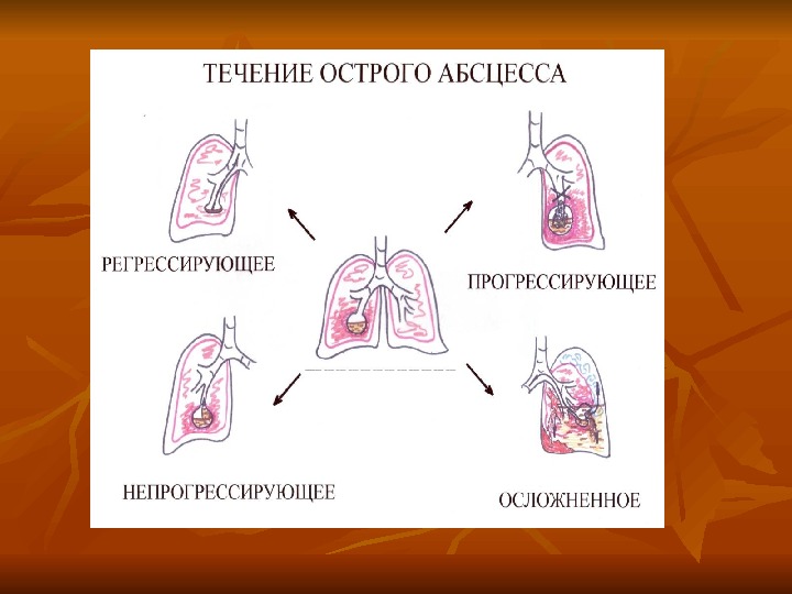 Абсцесс легкого презентация