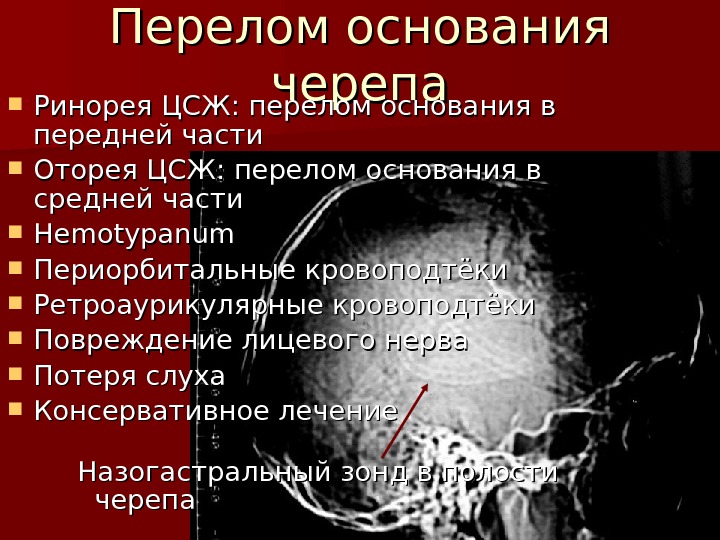 Перелом основания черепа карта вызова смп