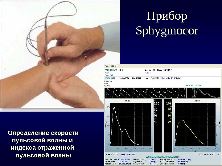 Измерение скорости волны. Измерение скорости пульсовой волны. Прибор для измерение пульсовой волны. Скорость распространения пульсовой волны. Пульсовая волна скорость пульсовой волны.