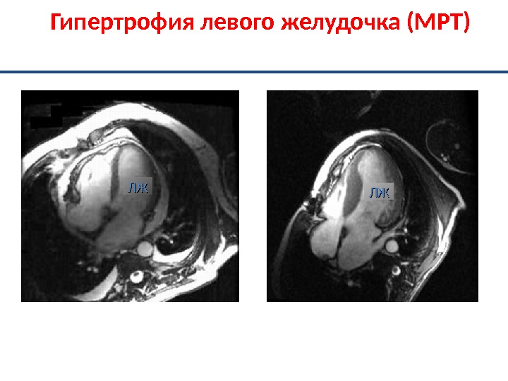 Мрт Сердца Цена В Москве Недорого К31