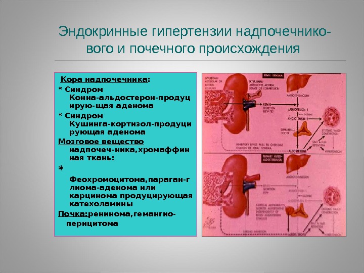 Почечная гипертония презентация