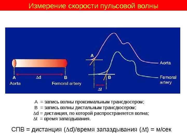 Сосудистая стенка вне пульсовой волны не пальпируется