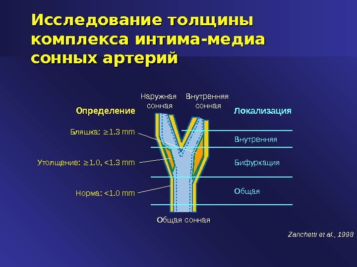 Бифуркация сонной. Толщина Ким сонных артерий норма. Комплекс интима-Медиа сонных артерий. Толщина комплекса интима-Медиа сонной артерии. Норма толщины интима Медиа сонных артерии.