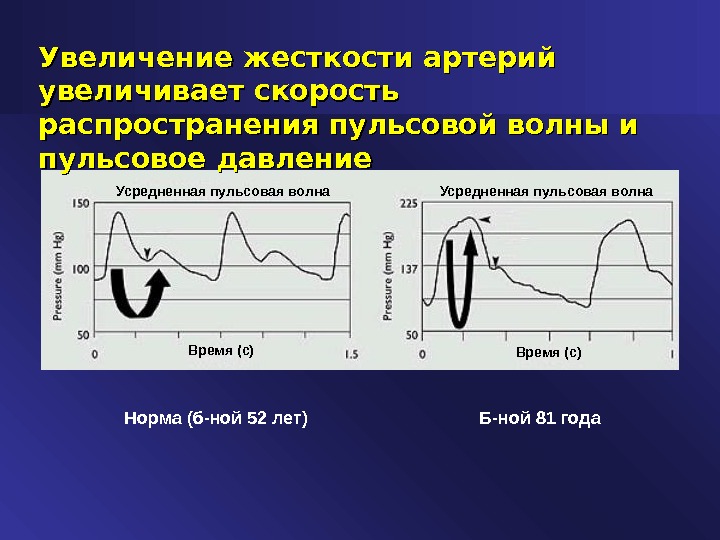 Давление волны