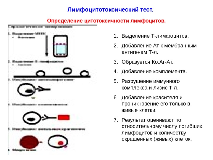 Тест определение. Оценка цитотоксической активности т-лимфоцитов. Схема микролимфоцитотоксического теста. Шкала оценки лимфоцитотоксического теста. Методы лабораторного определения цитотоксичности т клеток.