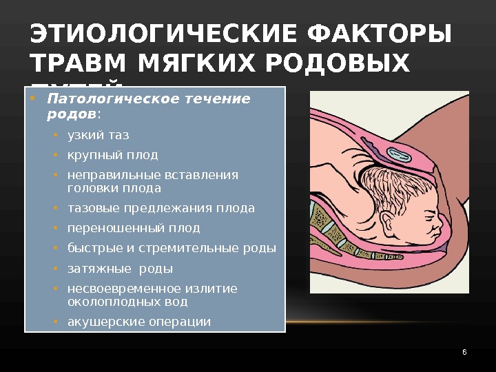 Безводный период в родах. Родовые травмы плода в акушерстве. Акушерский травматизм осложнения. Безводный промежуток в родах в норме. Патологическое течение родов.