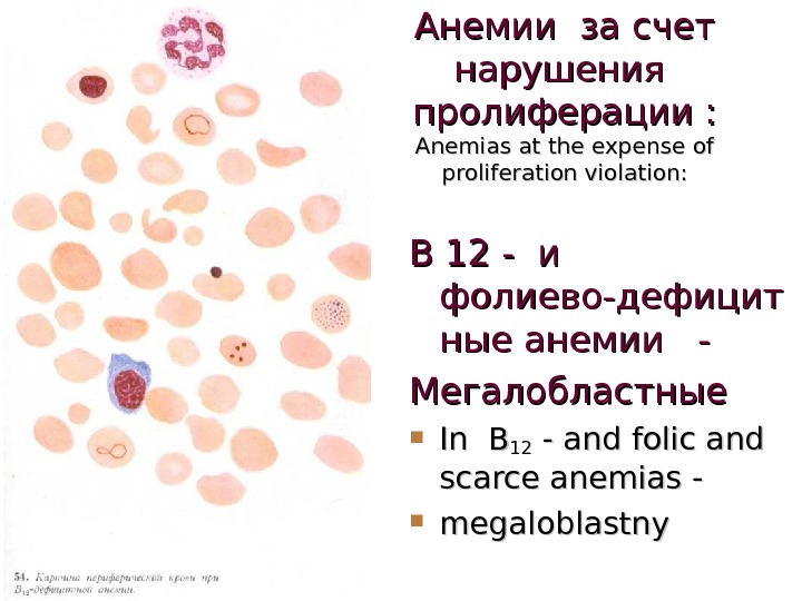 Презентация на тему анемия у детей