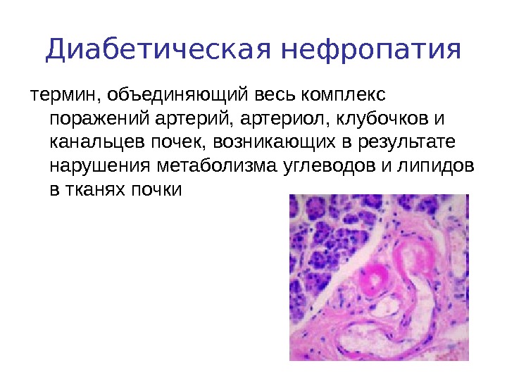 Сахарный диабет патанатомия презентация