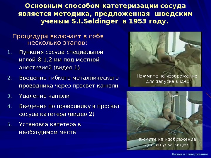 Презентация Ангиография