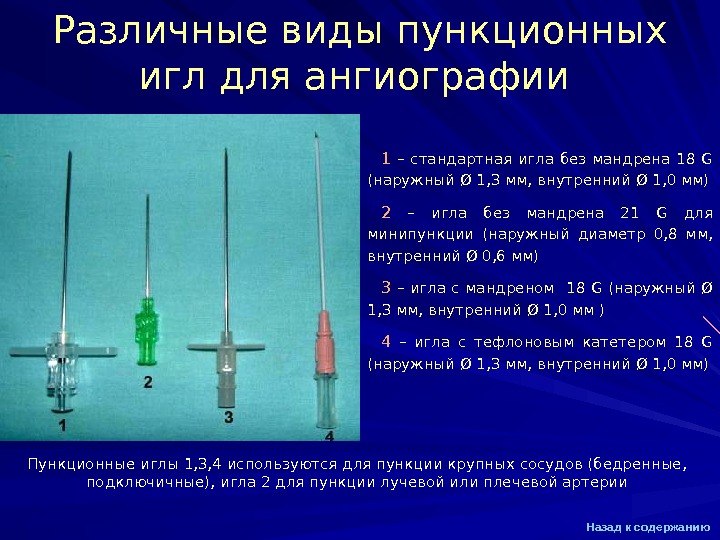 Презентация Ангиография