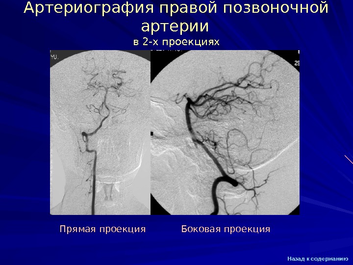 Почечная ангиография презентация