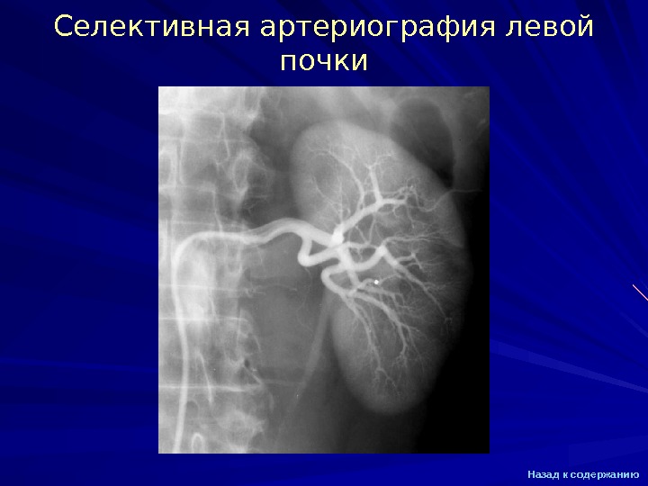 Почечная ангиография презентация