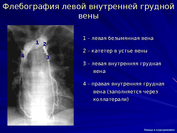 Левое внутреннее