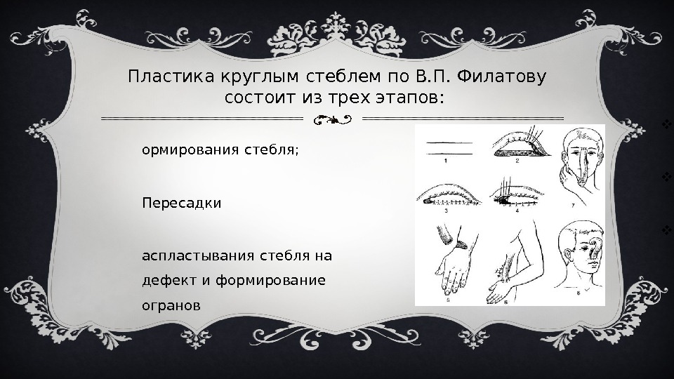 Филатовский стебель презентация