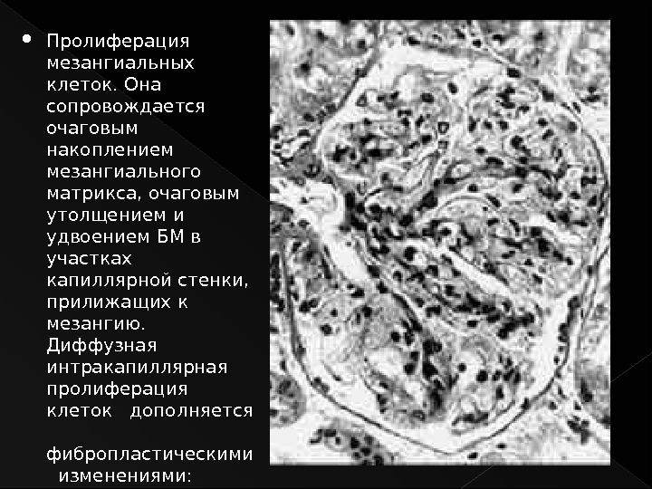 Пролиферация клеток. Пролиферация мезангия. Пролиферация мезангиальных клеток. Мезангиальные клетки почек. Пролиферация опухолевых клеток.