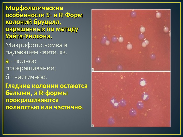 Бруцеллез презентация по микробиологии