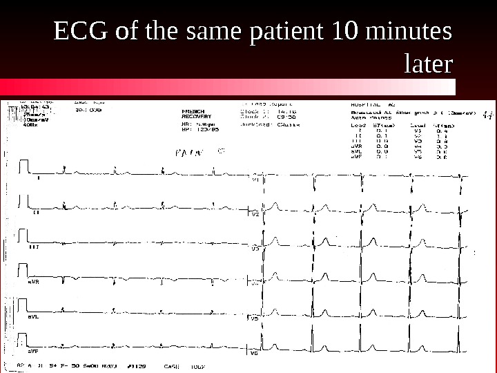 CHEST PAIN Differential Diagnosis Vladimir