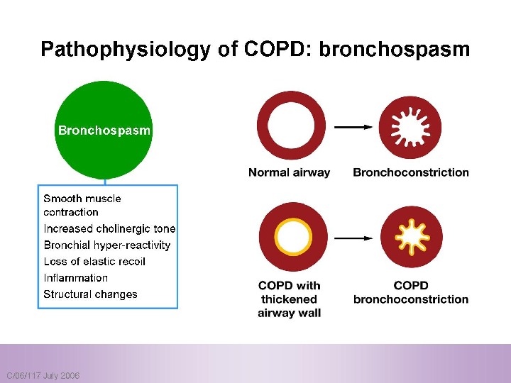 Chronic Obstructive Pulmonary Disease (( COPD