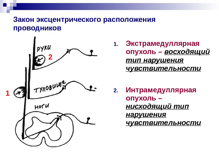Презентация Чувствительность и ее нарушения