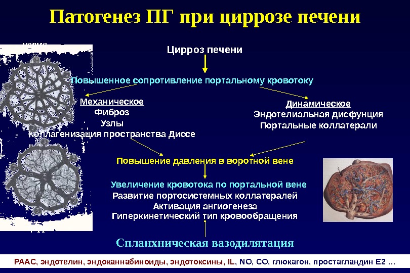 Механизм развития цирроза. Цирроз печени патофизиология. Патогенез вирусного цирроза.